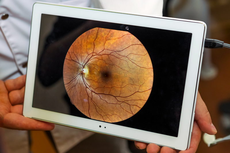 ¿QUE ES EL GLAUCOMA?